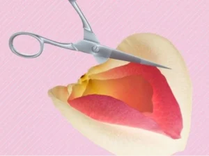 همه‌چیز درباره عمل مجدد یا ترمیم لابیاپلاستی