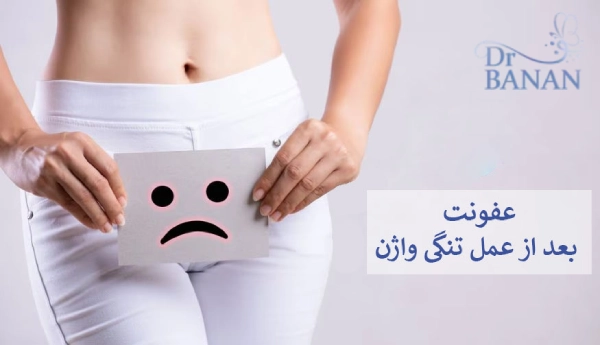 عفونت بعد از عمل تنگی واژن