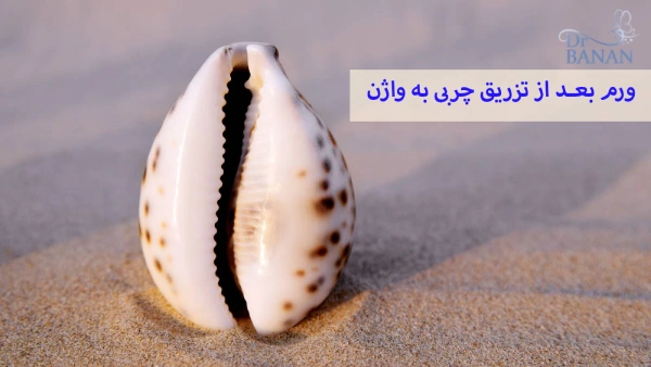ورم بعد از تزریق چربی به واژن