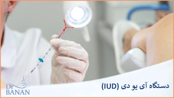 دستگاه آی یو دی (IUD)